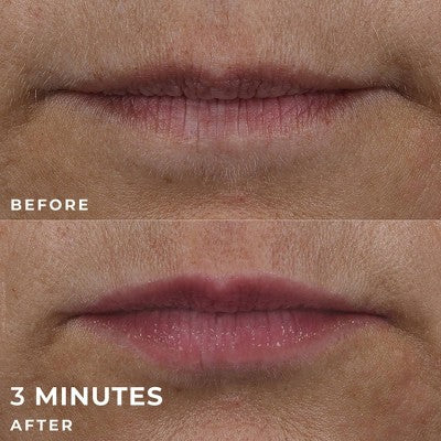 RoC Derm Correxion Lip Volumizer Treatment 0.34 fl oz - Imperfect Box