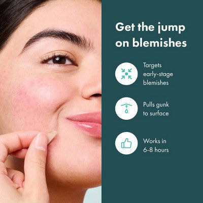 Hero Mighty Patch Micropoint for Blemishes 8ct - Imperfect Box