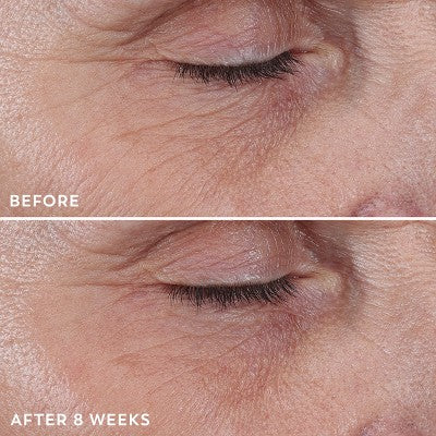 Olay Regenerist Anti-Aging Eye Wrinkle Treatment, Firming & Hydrating 0.68 fl oz - New
