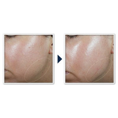 RoC Derm Correxion Contour Cream for Face and Neck 1.7oz - Imperfect Box