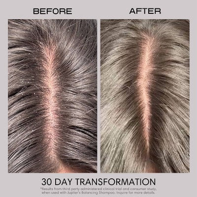 Jupiter Anti-Dandruff Restoring Scalp Serum 2.1 fl oz - Imperfect Container