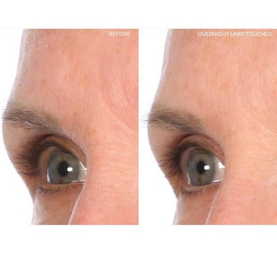 SiO Beauty Brow Lift Face Mask 1ct - New