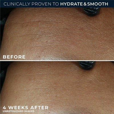 RoC Retinol Correxion Line Smoothing Max Hydration Cream 1.7oz - Imperfect Box