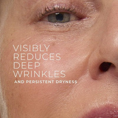 RoC Retinol Correxion Deep Wrinkle Rich Cream 1.7oz - Imperfect Box