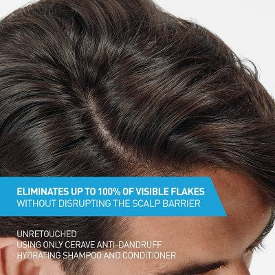 CeraVe Anti-Dandruff Scalp Care Shampoo - 12 fl oz