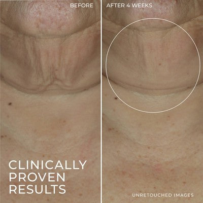 RoC Derm Correxion Retinol Face Stick - Imperfect Box