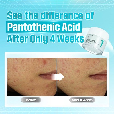 numbuzin No.1 Pantothenic B5 Active Soothing Face Cream 2.7 fl oz - Imperfect Box