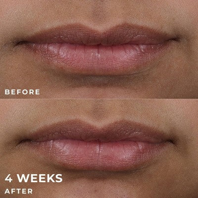 RoC Derm Correxion Lip Volumizer Treatment 0.34 fl oz - Imperfect Box