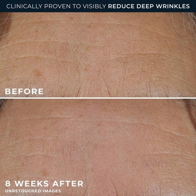 RoC Retinol Correxion Deep Wrinkle Rich Cream 1.7oz - Imperfect Box
