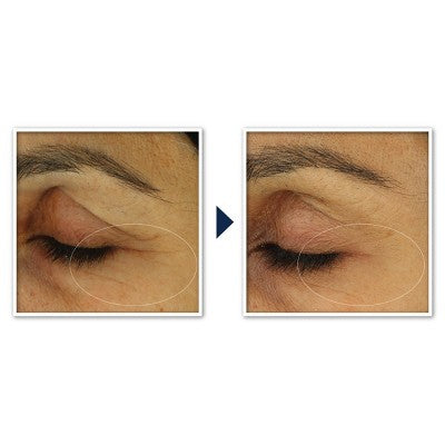 RoC Retinol Correxion Line Smoothing Anti-Aging Wrinkle Eye Cream 0.25oz - Imperfect Box