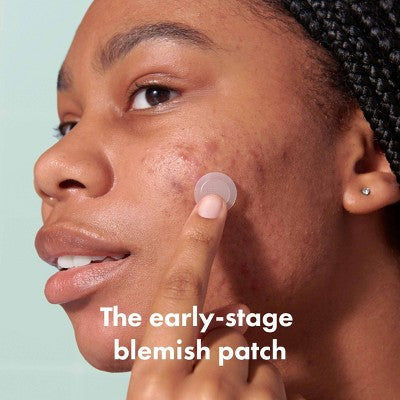 Hero Mighty Patch Micropoint for Blemishes 8ct - Imperfect Box