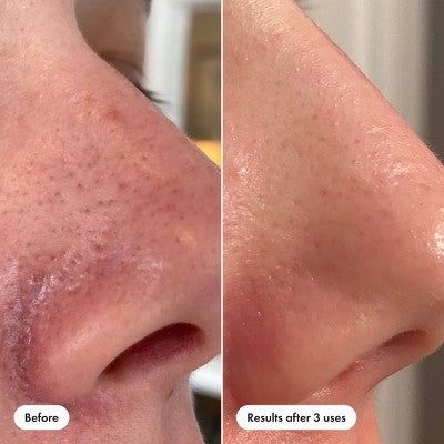 Hero Pore Release 100ml - Imperfect Box