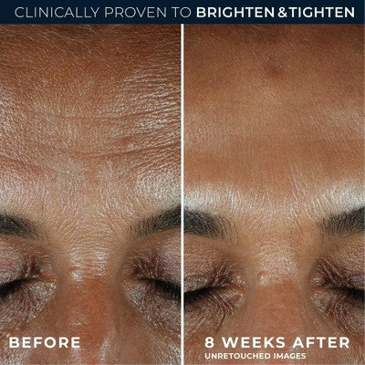 RoC Brightening Anti-Aging Serum with Vitamin C for Dark Spots 1.0 fl oz - Imperfect Box