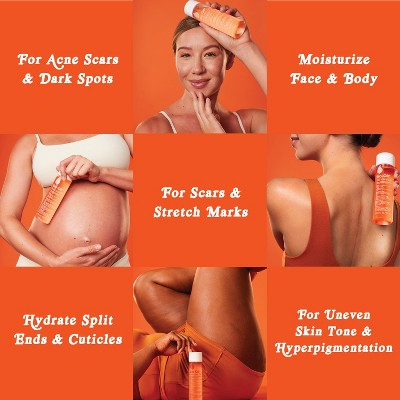 Bio-Oil Skincare Body Oil and Scar Treatment with Vitamin E 4.2 fl oz - Missing Box