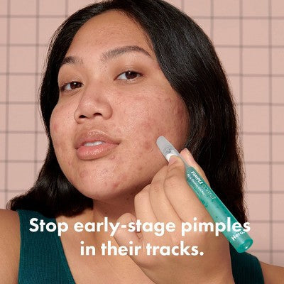 Hero Pimple Correct Pen 0.34 fl oz EXP 04/2026 - New