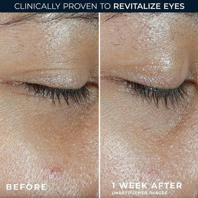 RoC Multi Correxion Revive and Glow Vitamin C Under Eye Balm 0.14oz - Imperfect Box