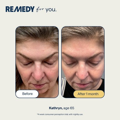 Remedy Skin Healthy Aging Serum 1 fl oz - Imperfect Box