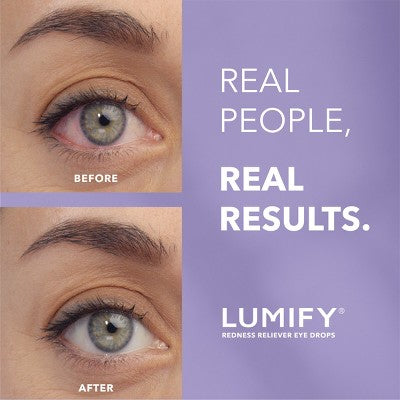 Lumify Eye Drops for Redness Relief 2.5ml - New