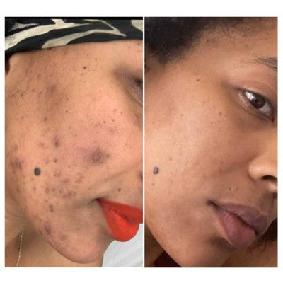 Urban Skin Rx Retinol Rapid Repair and Dark Spot Treatment 1 fl oz - Imperfect Box